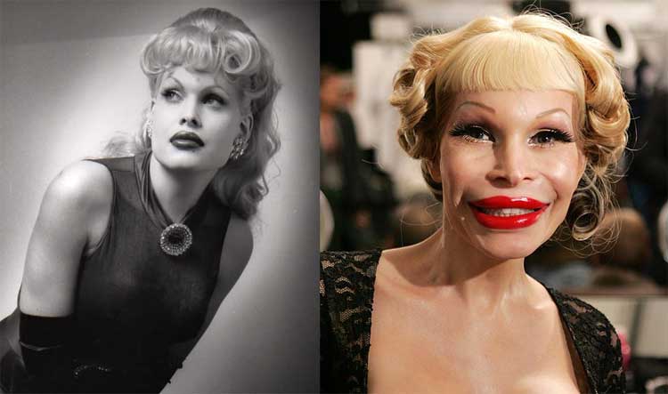 amanda-lepore-before-after