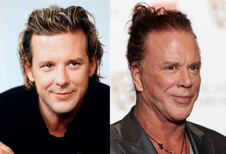 mickey-rourke-before-after